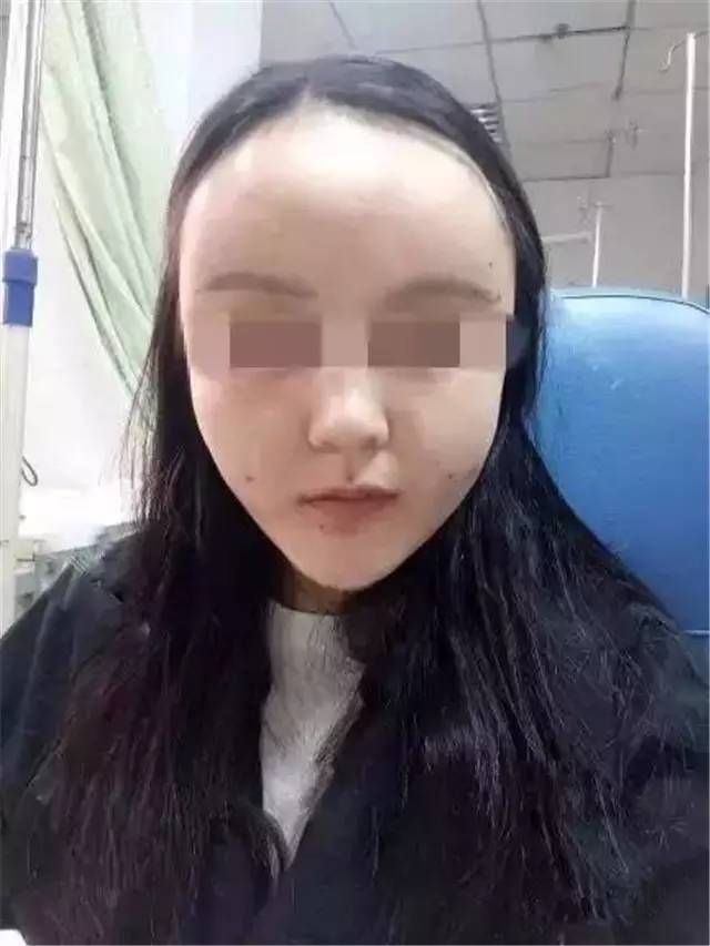 【专家美谈】自体脂肪填充后脸肿很后悔!那是因为你不知道这些!