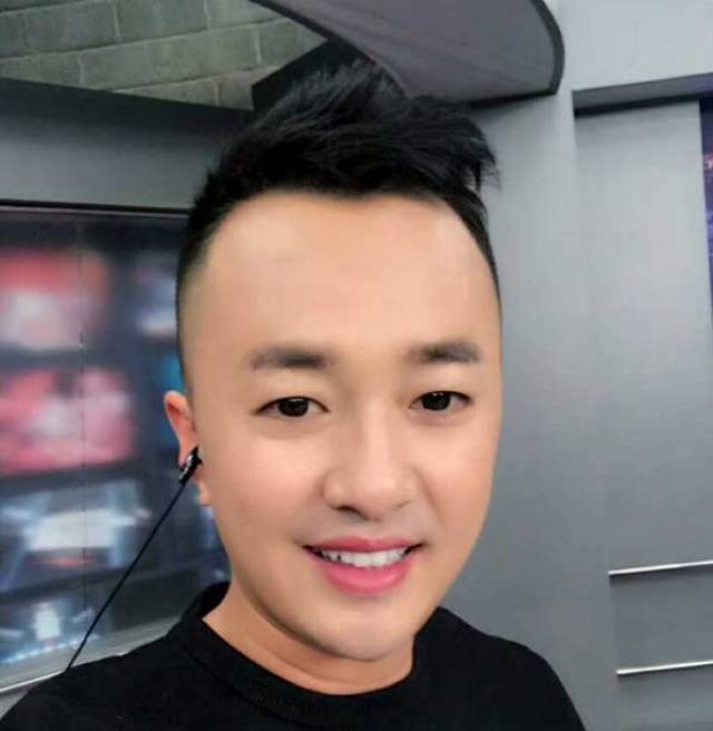 阿楠 电视台主持人(发际线种植)