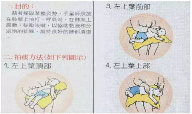 宝宝咳嗽的家庭护理,象妈妈教你如何给宝宝拍痰?