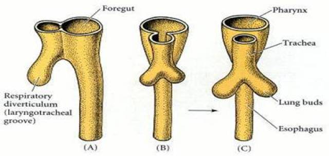 上消化道-气管造影虽然是食道气管瘘的重要参考,却可能漏诊先天性喉裂