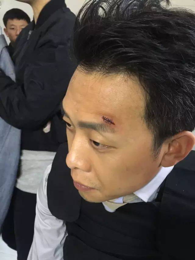 逼真战争伤效妆鉴赏