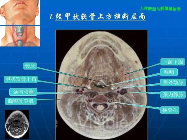 颈部横断面图片