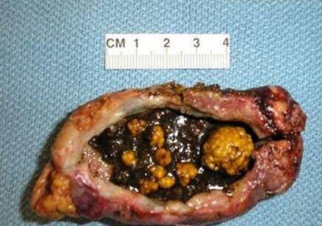 溶安茶说不查清楚就误事了_手机搜狐网