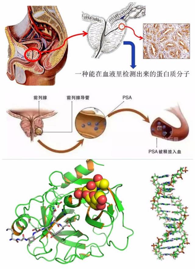 10月健康講座:psa(前列腺特異抗原)的臨床應用