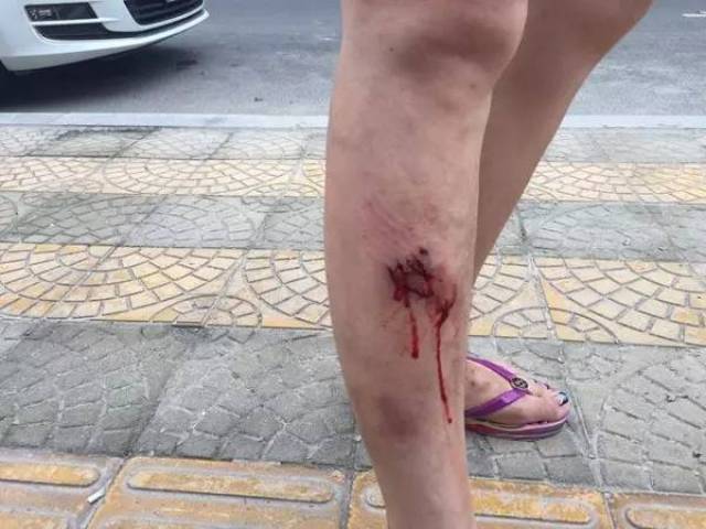 遇到恶犬的时候应该如何自保?