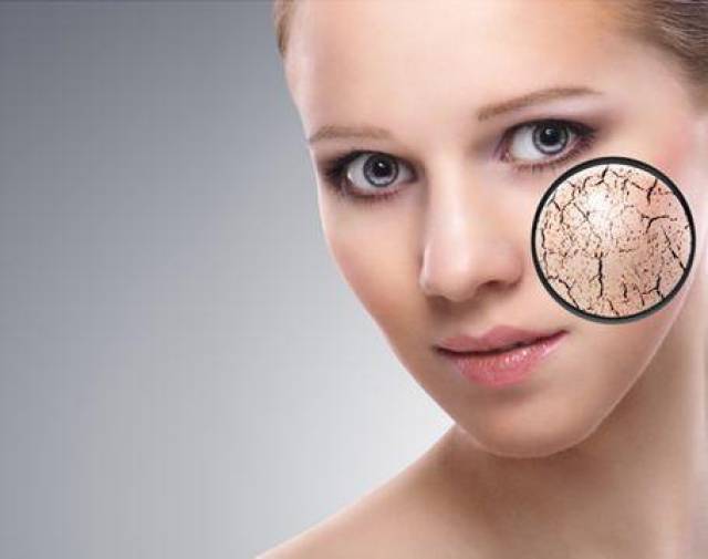 终于,在秋冬是肌肤最不稳定的季节,干燥,脱皮,红血丝等一系列问题在