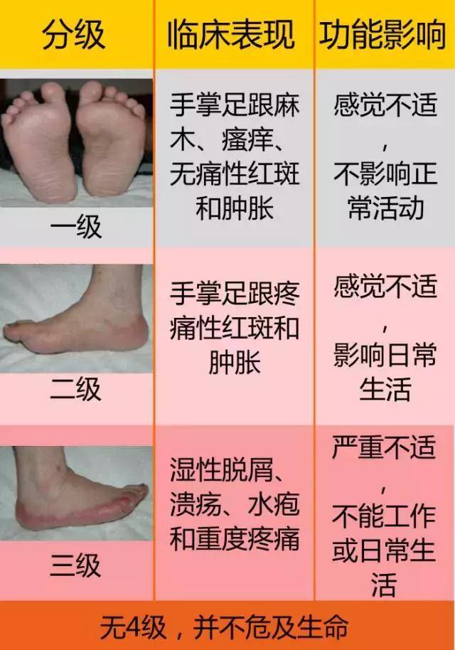 朋友圈让人头疼的手足综合征来学学癌症患者的小妙招吧