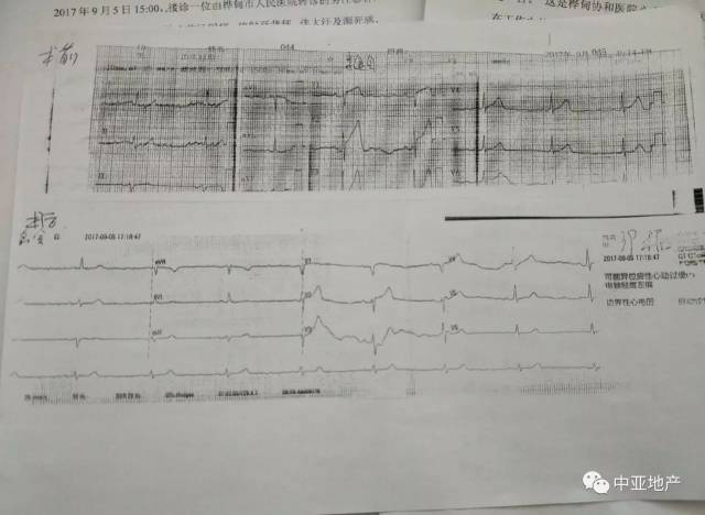 病历二(急性心肌梗死——静脉溶栓治疗)