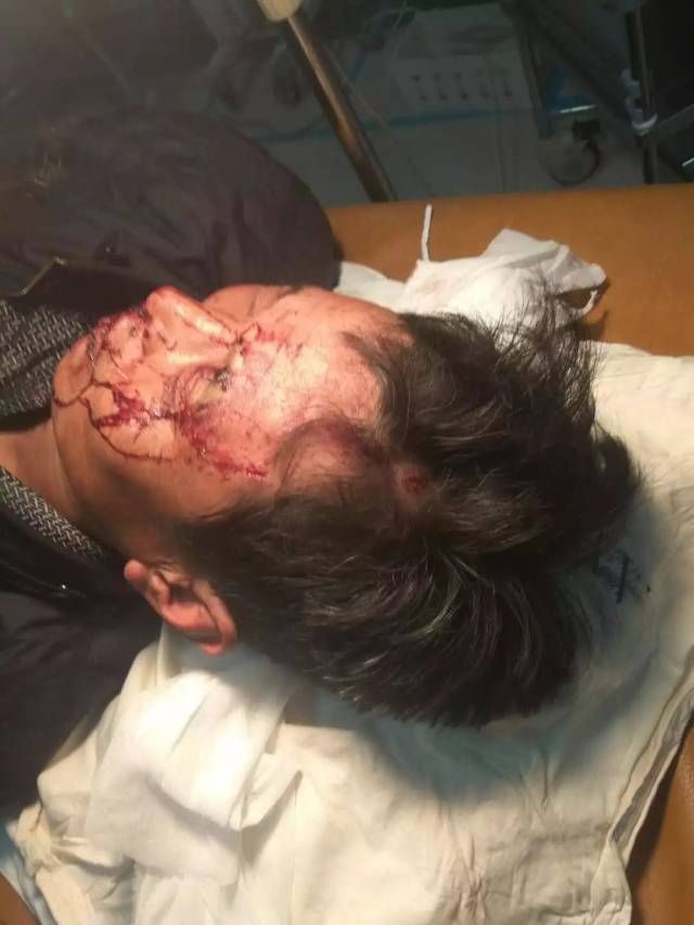 横山区发生一起恶性伤人案件!"只因在人群中多看了你一眼"