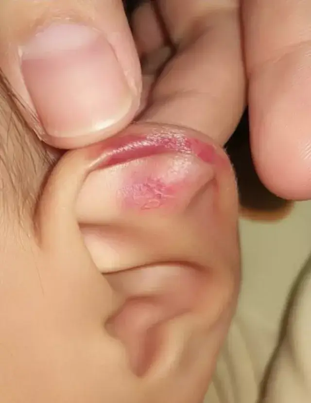 还有的孩子精神上甚至出现了问题.