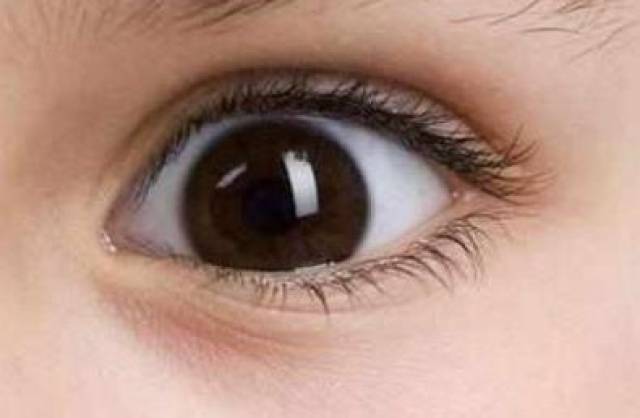 龙眼配上这种痣不想富贵都不行