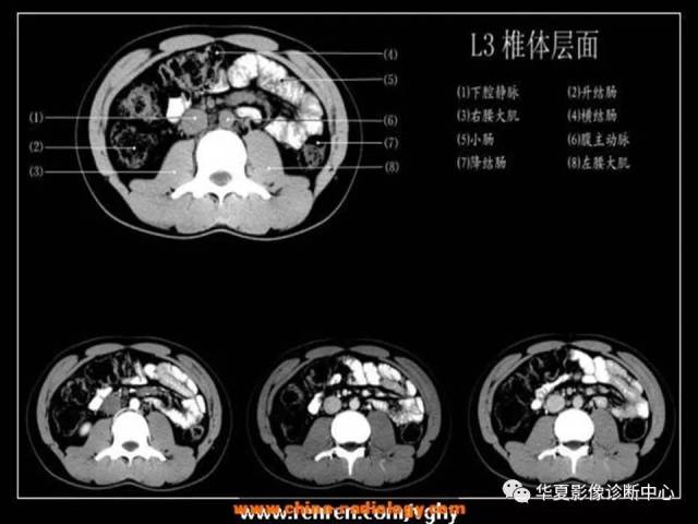读懂腹部ct解剖,只花1小时