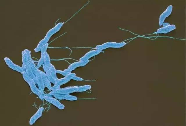 不容小视的食源性致病菌——空肠弯曲菌,一起认清它的真面孔!