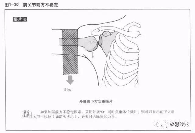 (1)鎖骨的x線解剖在後前位x線片上,長管狀的鎖骨,重疊在肺尖部,把胸骨