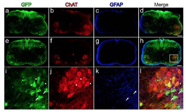 scaav9对sma小鼠模型作用