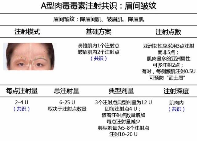 【干货】a型肉毒毒素治疗亚洲人策略建议:国际化 多学科 泛亚洲共识