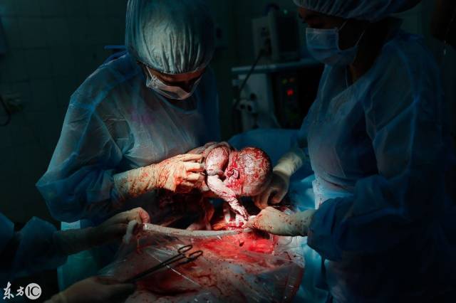 男人自己生孩子手术图片