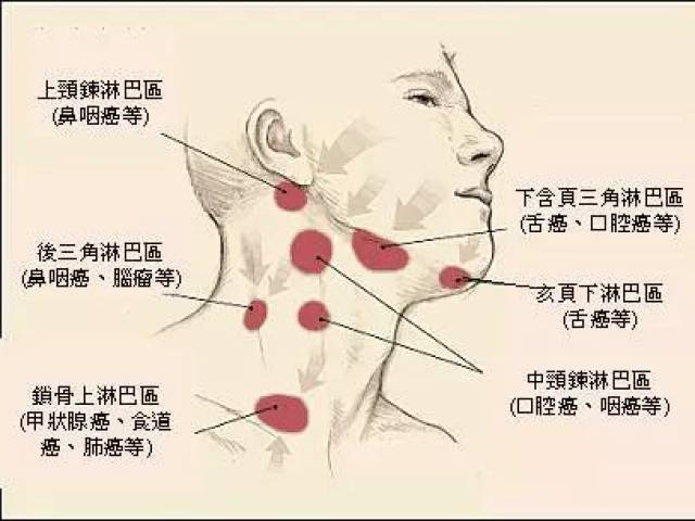 头部八个淋巴结位置图片