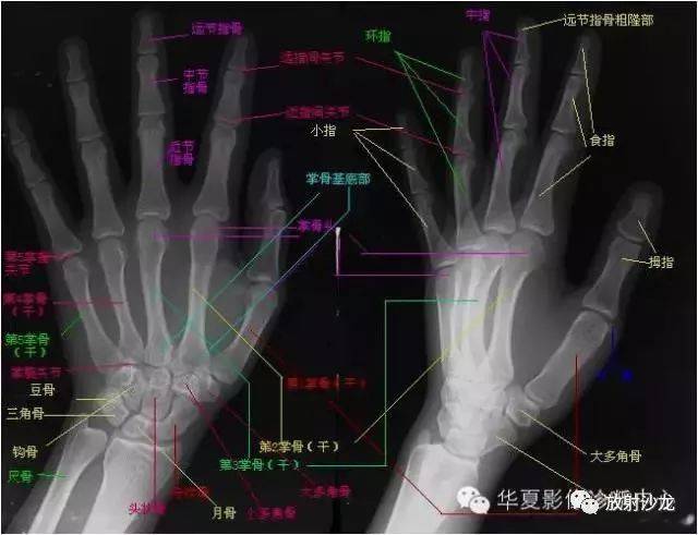 腕关节横断面解剖图图片