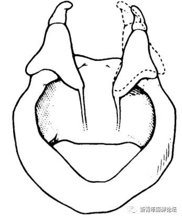 arytenoid cartilage图片