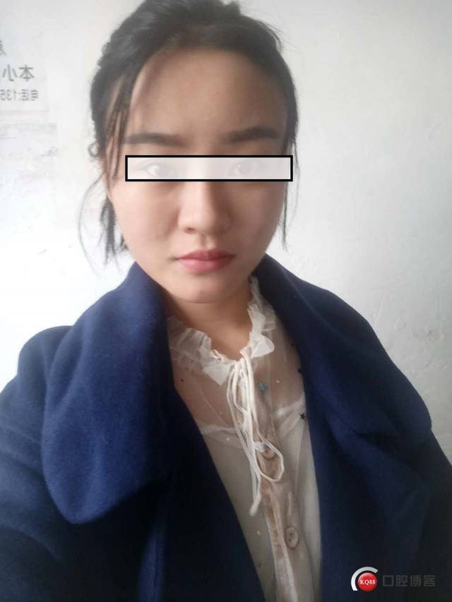 拔牙引发颌面部皮下气肿一例_手机搜狐网
