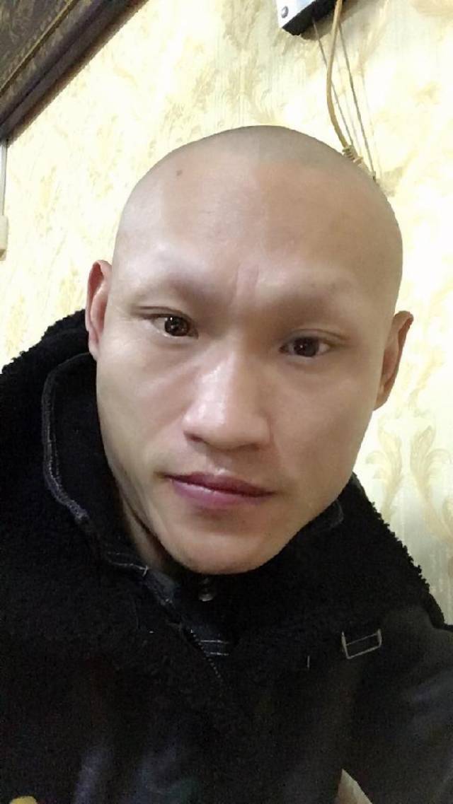 影视演员六子为什么没有眉毛了