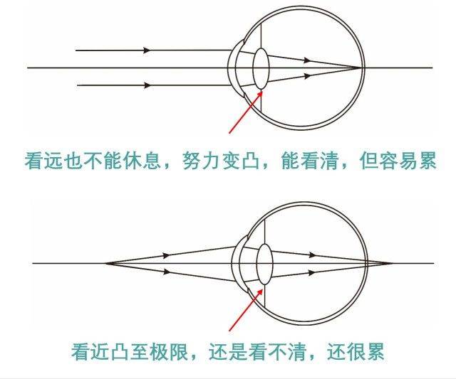 鸡西光明眼镜 用最省力的方式向顾客解释老花,马上告诉你