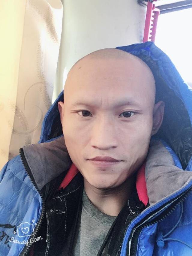 影视演员六子头发眉毛掉光