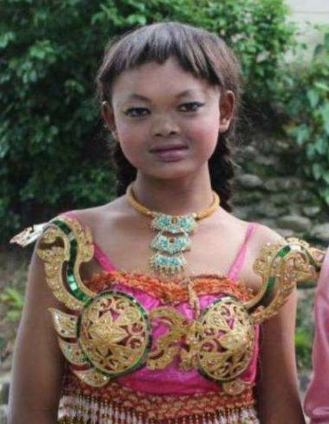 因丑受尽歧视的男人,整容后震惊了亚洲!