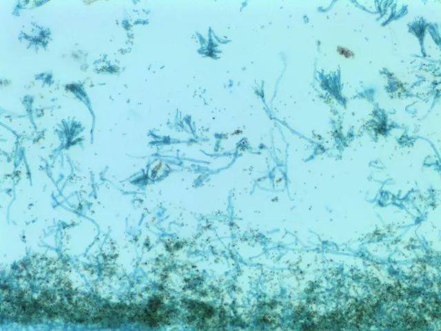 青霉菌油镜图片图片
