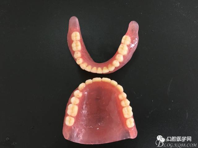 hch全口病例记录(附视频地址)