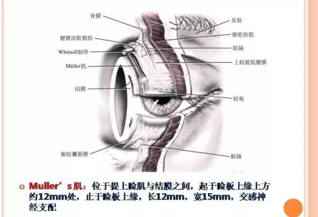 muller肌眼睑图片