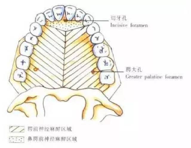 口腔麻醉区域图图片