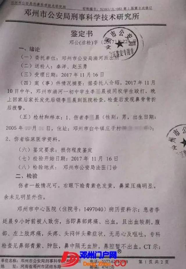 【校園暴力】鄧州一中學生被打致二級輕傷