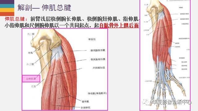 肘关节的解剖太详细了!