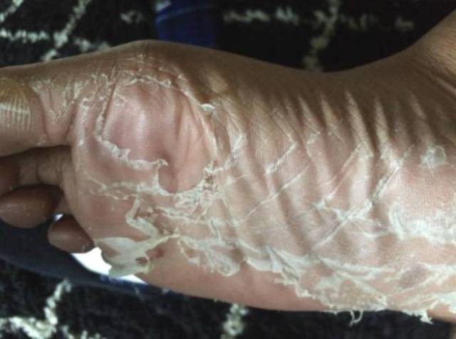 这个让脚一层一层脱皮的足膜,网友们一边忍着恶心一边看,一边又忍不住