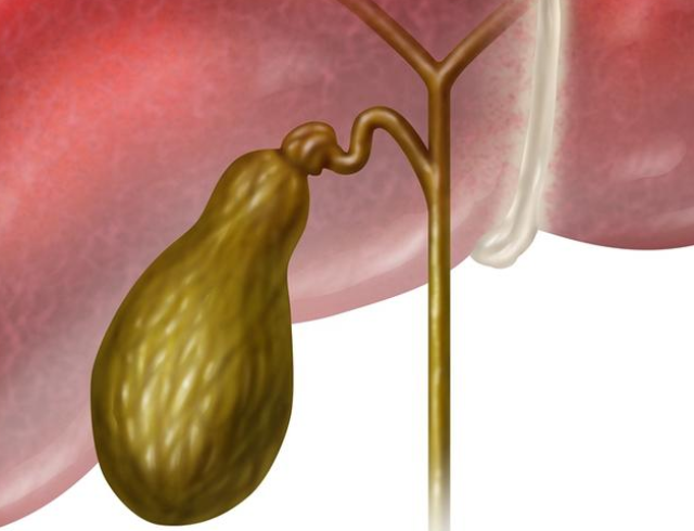 發病率低於1%的膽囊癌 術後生存率竟不到1年!