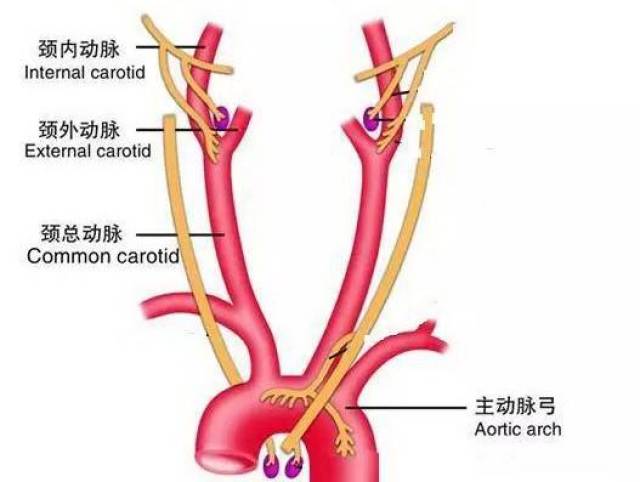 颈动脉斑块出现怎么办?