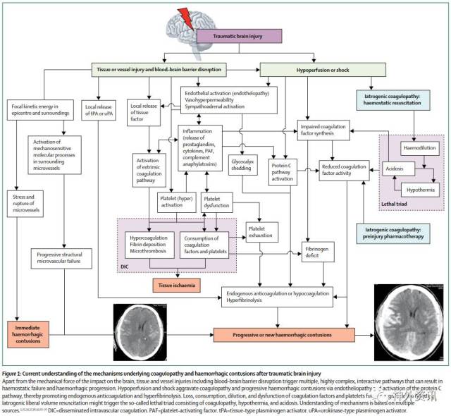 图1 目前对颅脑创伤后凝血障碍和出血机制的理解