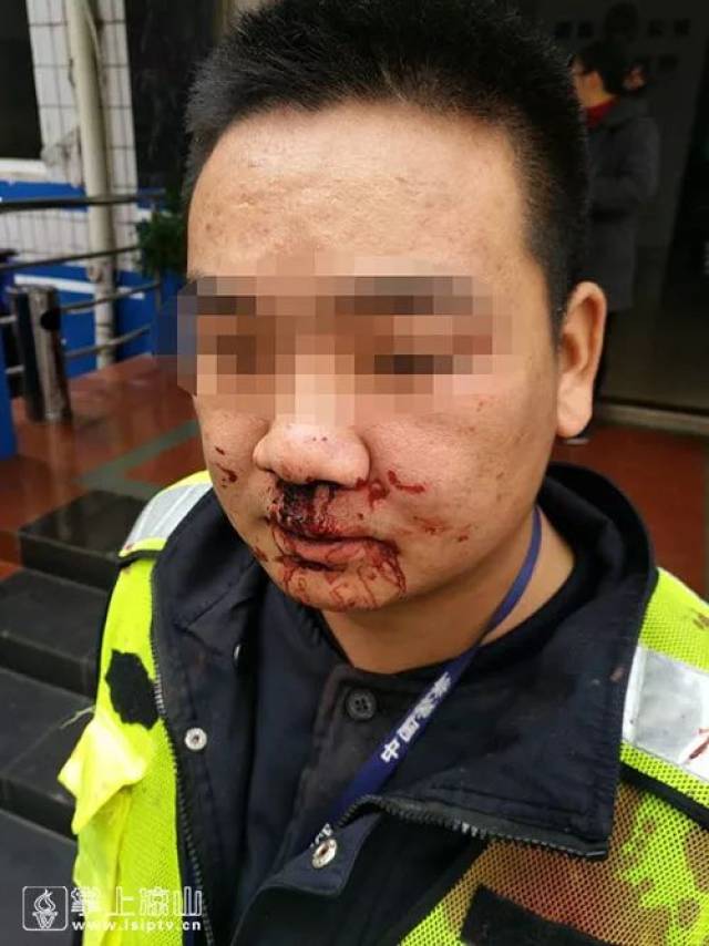 太惨了!西昌一交警被打的满脸是血