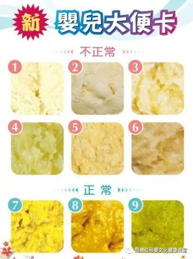 正常大便:黄色或土黄色,黏稠,不成形,略有酸味,不臭,每日2～5次