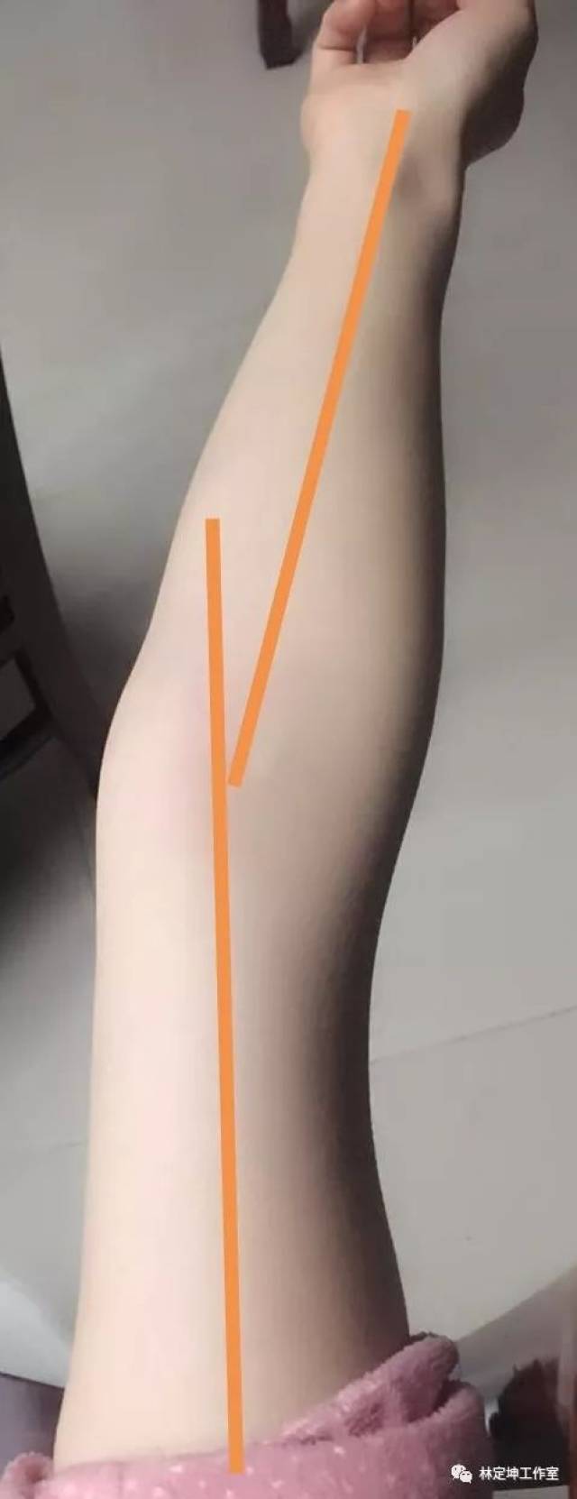 "电脑族"的通病,如何预防?