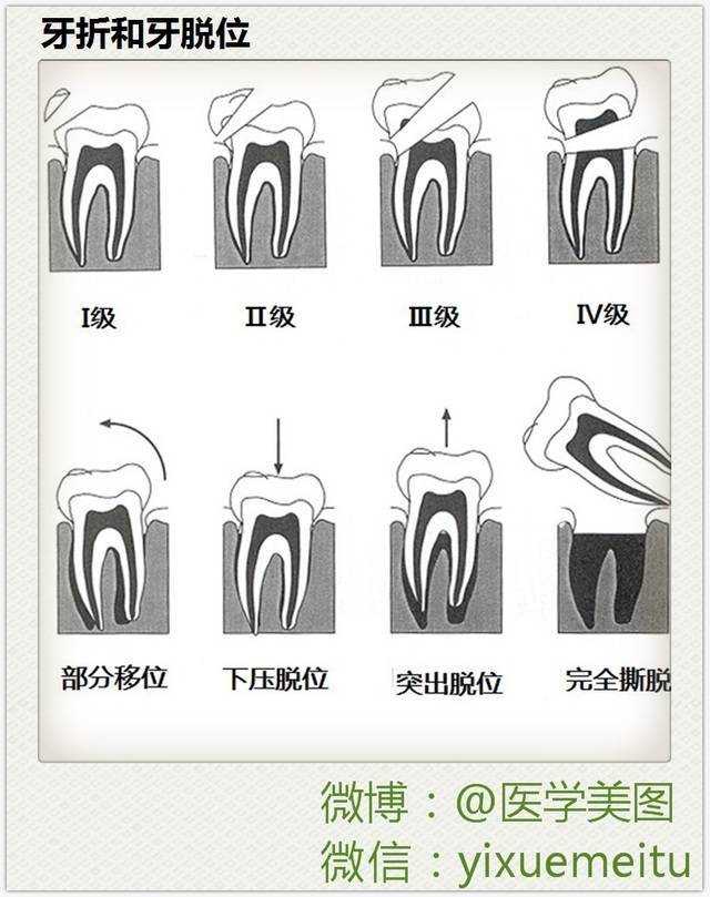 口腔科高速手机图解图片