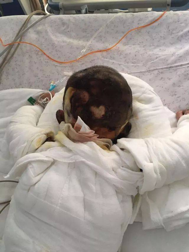 棉被,大人有事外出的十分钟后,发现家中起火,立即赶回家中,将小孩救出