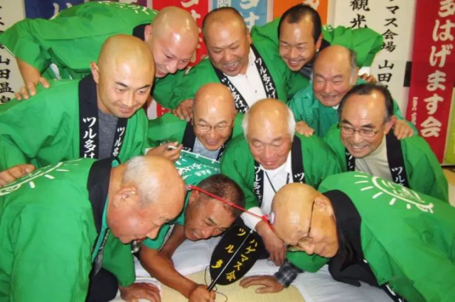 中国5个男人有1个秃顶,谢顶面积比半个广州还大!