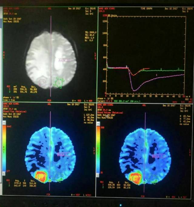 山东省医学影像学研究所于台飞教授来我院