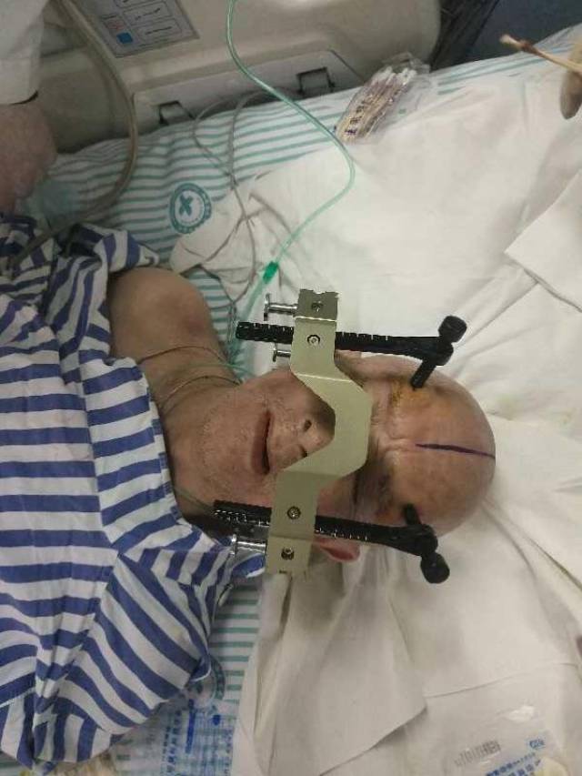 79歲老人發病中度昏迷,家屬拒絕開顱手術!醫院卻能這麼做?