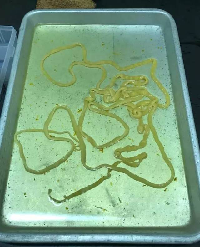 供图七八米长,弯弯绕绕,像一根白色粗面条,一条绦虫自主排出患者体外