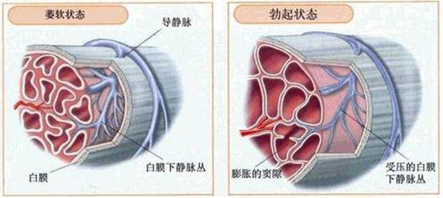 阴痉血管隆起 鼓起图片