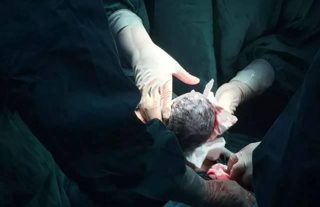 手术室医生会做什么?一起看看在和美生娃全过程!